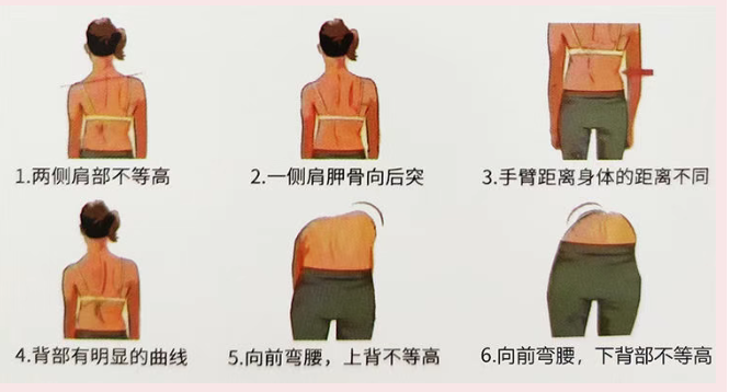 【招募令】寒假体态不良矫正营开营啦！